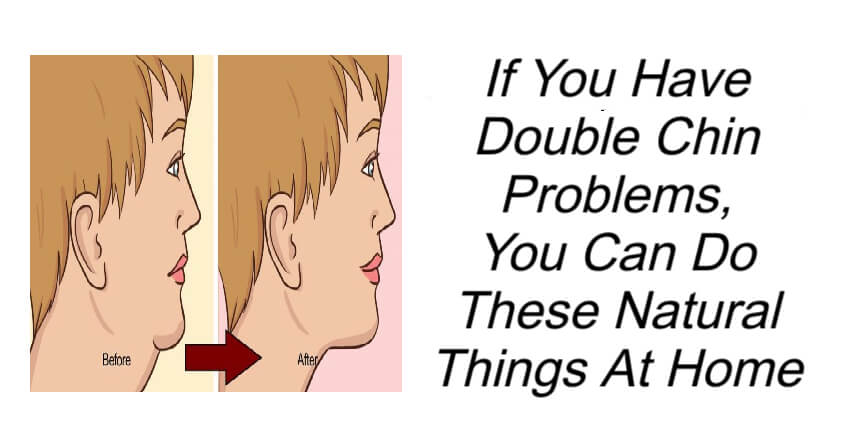 Double Chin Home Remedies
