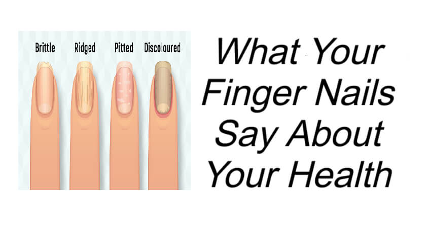 What Your Finger Nails Say About Your Health