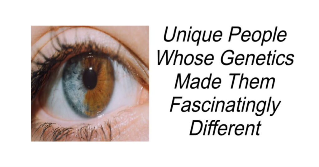 People Whose Genetics Made Them Fascinatingly Different