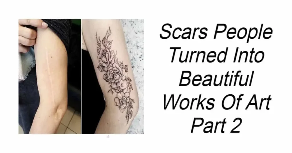 Scars People Turned Into Beautiful Works Of Art Part 2