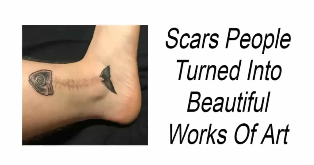 Scars People Turned Into Beautiful Works Of Art