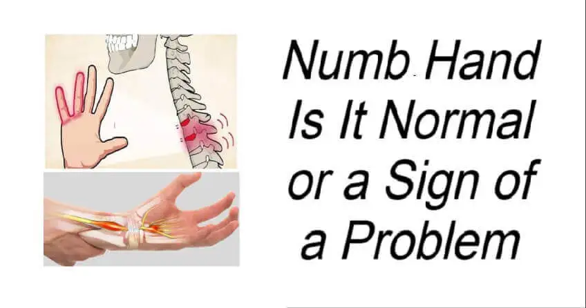 Numb Hand Is It Normal