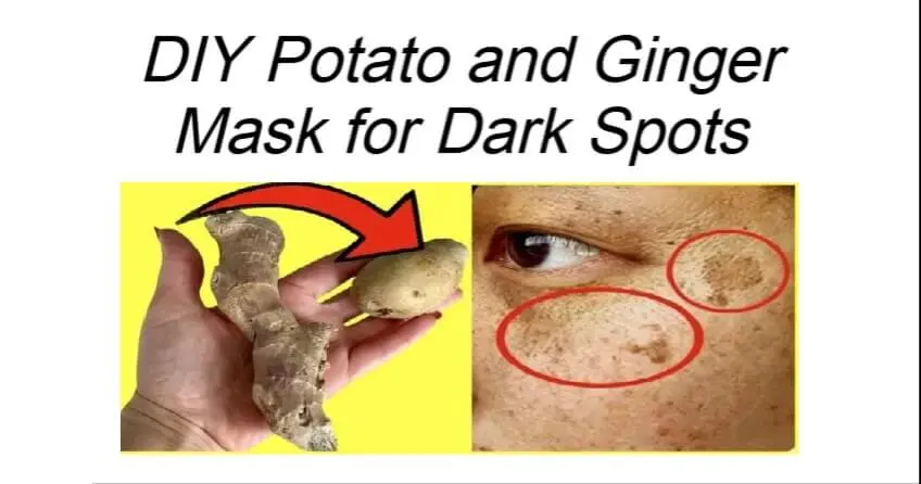 DIY Potato and Ginger Mask for Dark Spots