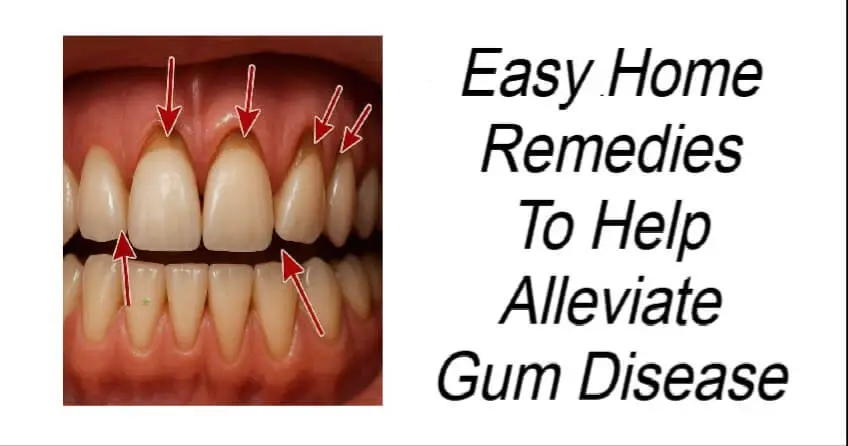 Easy Home Remedies To Help Alleviate Gum Disease