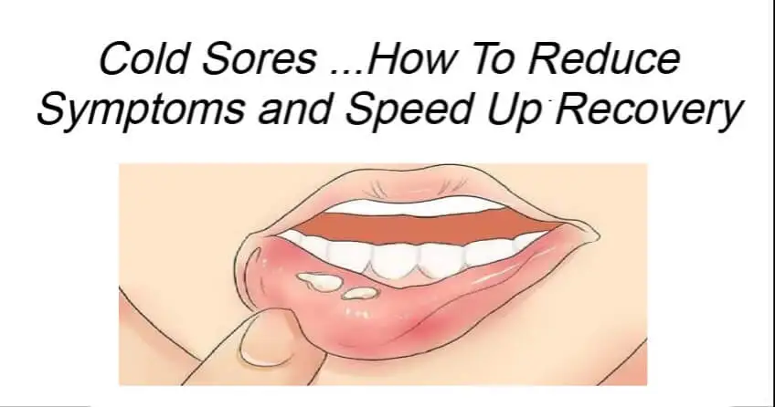 How To Reduce Symptoms and Speed Up Recovery