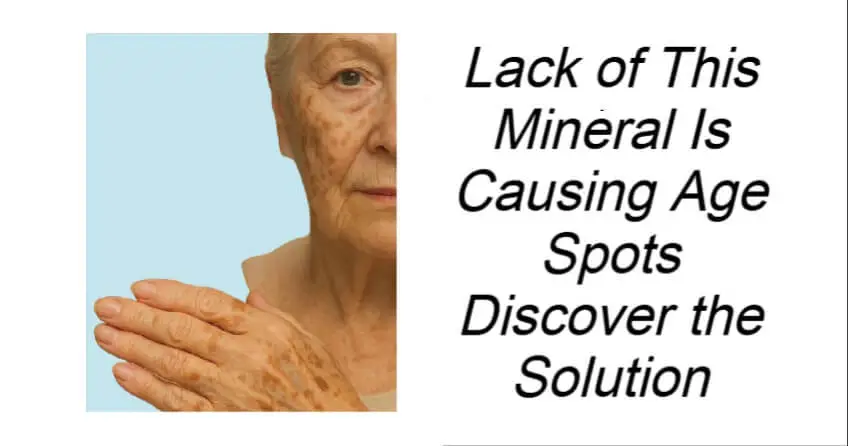 Lack of This Mineral Is Causing Age Spots