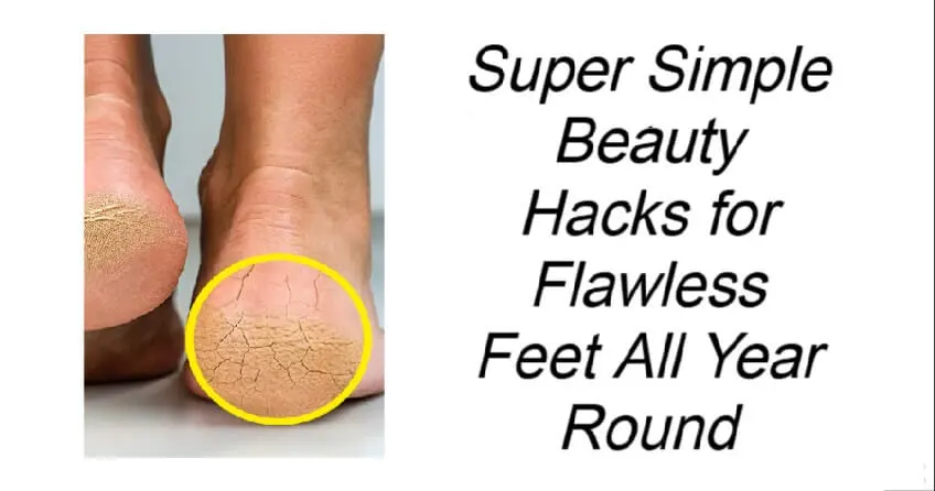 Super Simple Beauty Hacks for Flawless Feet All Year Round