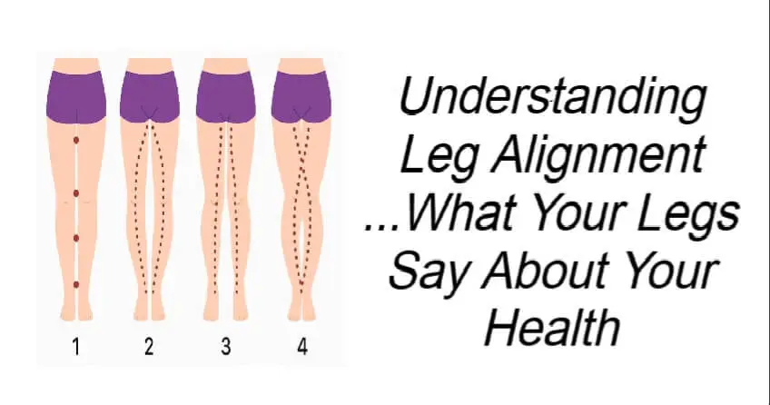 Understanding Leg Alignment