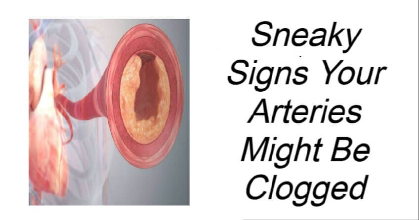 Sneaky Signs Your Arteries Might Be Clogged