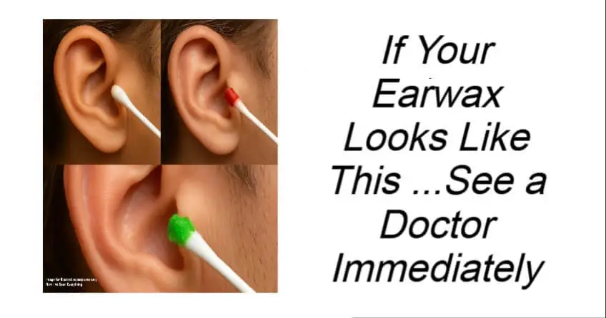 If Your Earwax Looks Like This