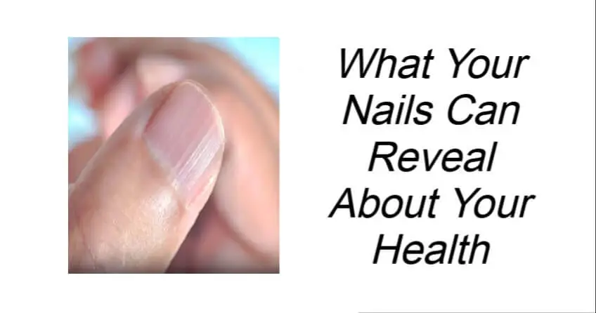 What Your Nails Can Reveal About Your Health