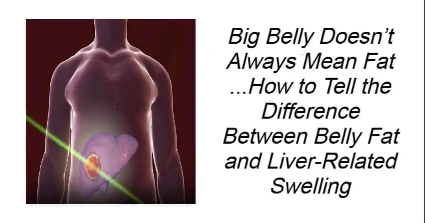 Big Belly Doesn’t Always Mean Fat