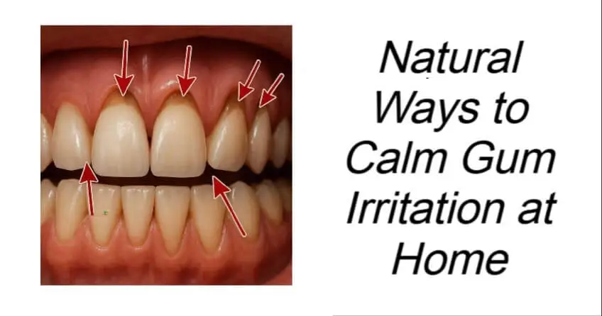 Natural Ways to Calm Gum Irritation at Home