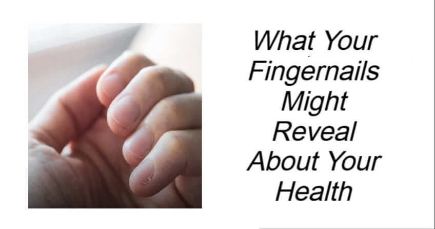 What Your Fingernails Might Reveal About Your Health