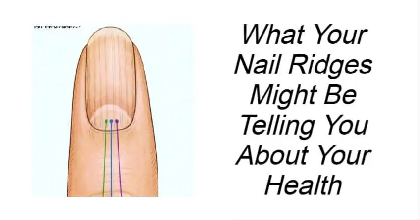 What Your Nail Ridges Might Be Telling You