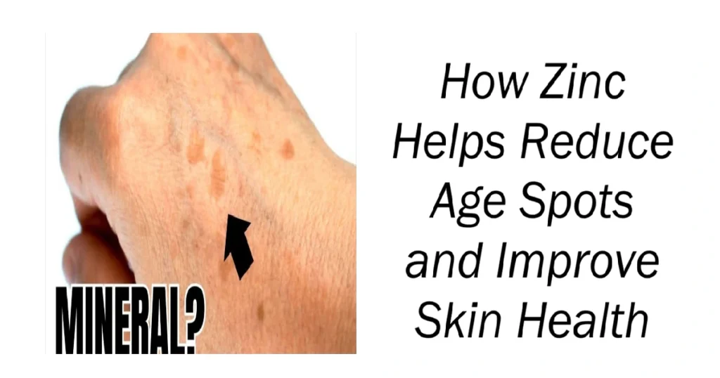 How Zinc Helps Reduce Age Spots