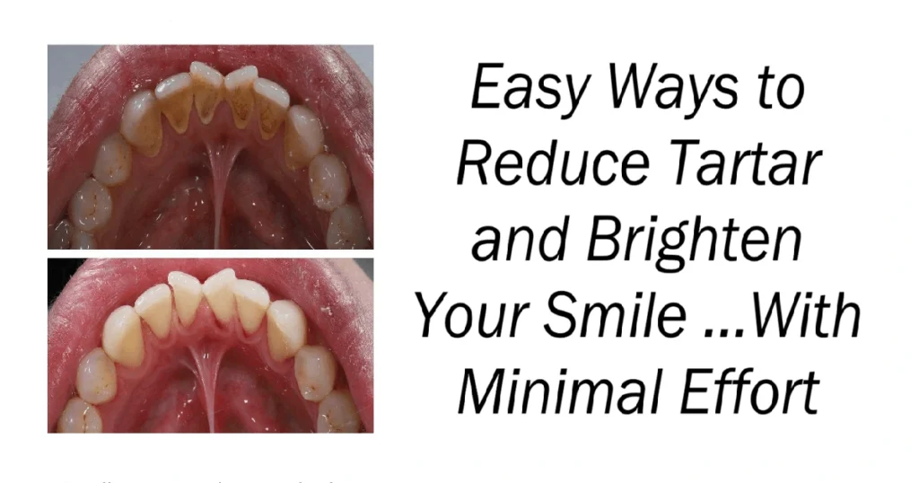 Easy Ways to Reduce Tartar and Brighten Your Smile