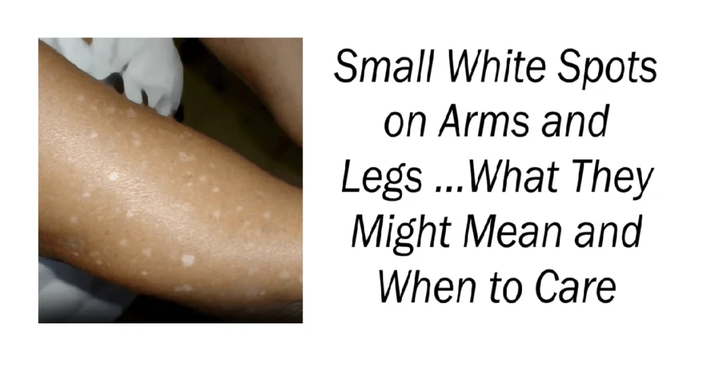 Small White Spots on Arms and Legs