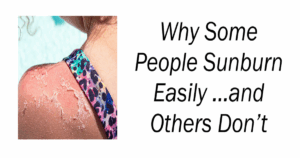 Why Some People Sunburn Easily