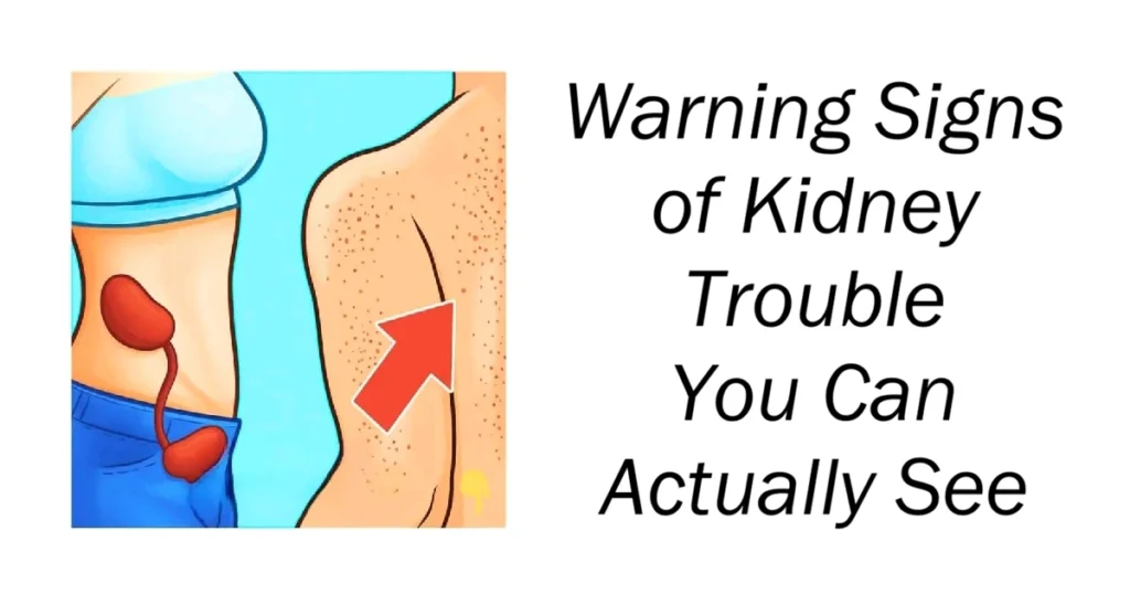 Warning Signs of Kidney Trouble You Can Actually See