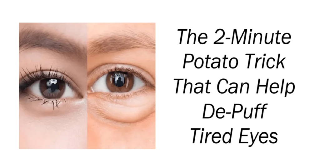 Potato Trick That Can Help De-Puff Tired Eyes