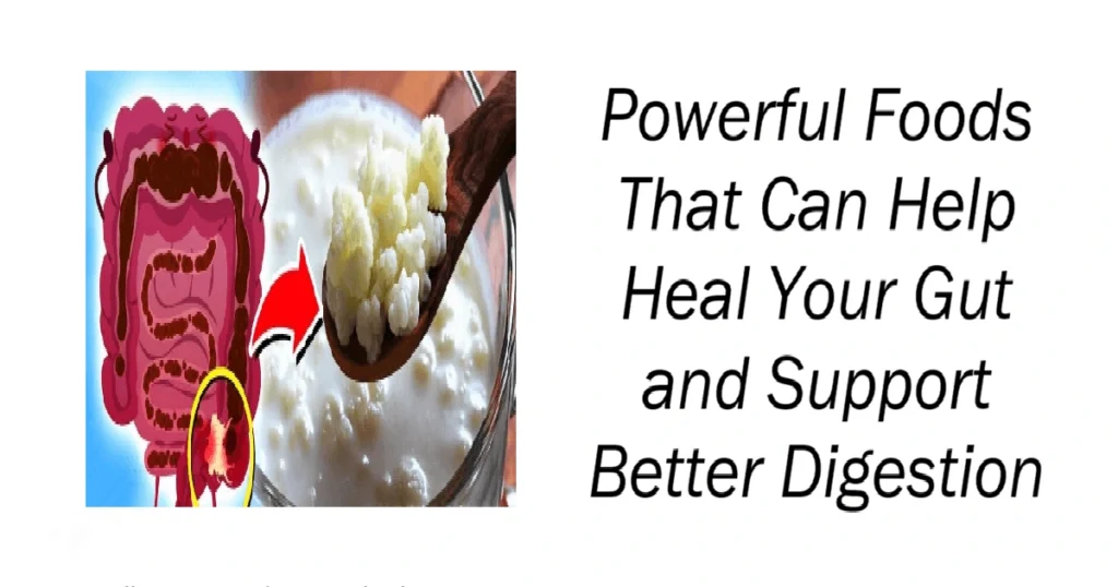 Powerful Foods That Can Help Heal Your Gut