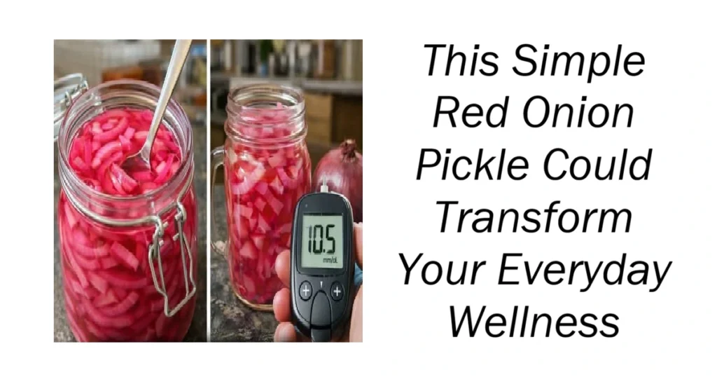 Red Onion Pickle