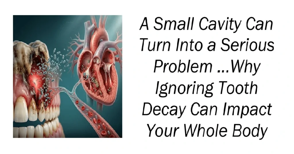 A Small Cavity Can Turn Into a Serious Problem