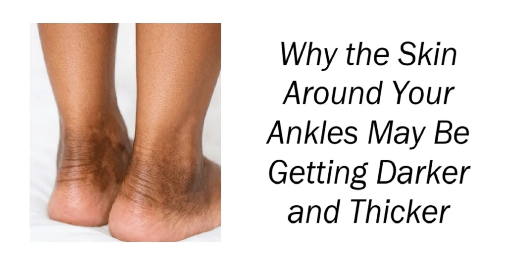 Skin Around Your Ankles