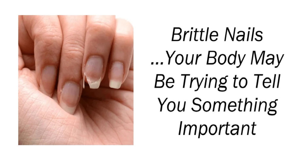 Brittle Nails
