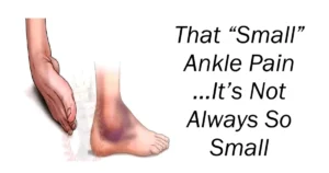 That “Small” Ankle Pain