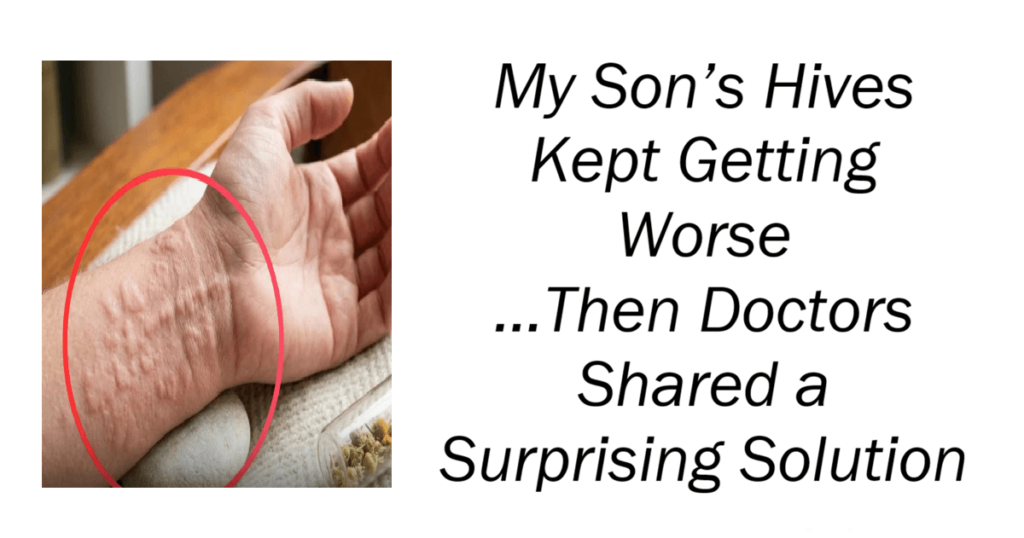 My Son’s Hives Kept Getting Worse