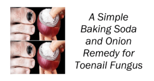 Remedy for Toenail Fungus