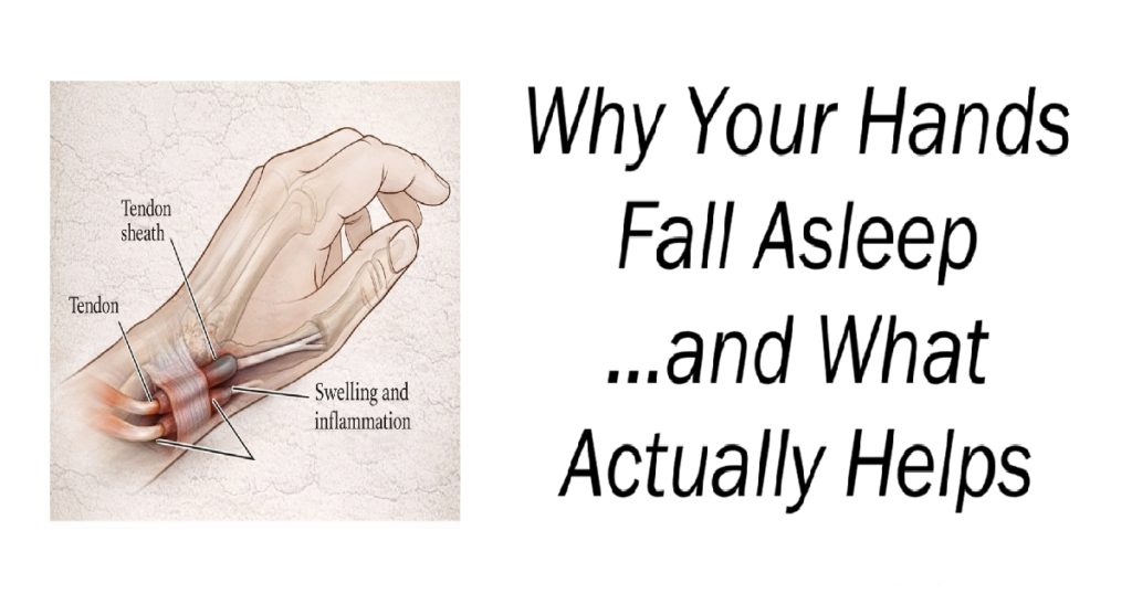 Why Your Hands Fall Asleep