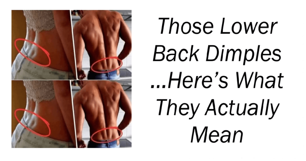 Those Lower-Back Dimples