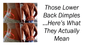 Those Lower-Back Dimples