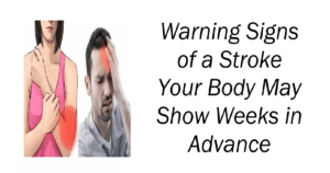 Warning Signs of a Stroke Your Body May Show