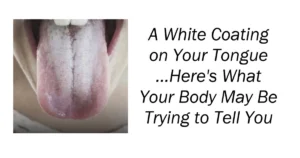 A White Coating on Your Tongue