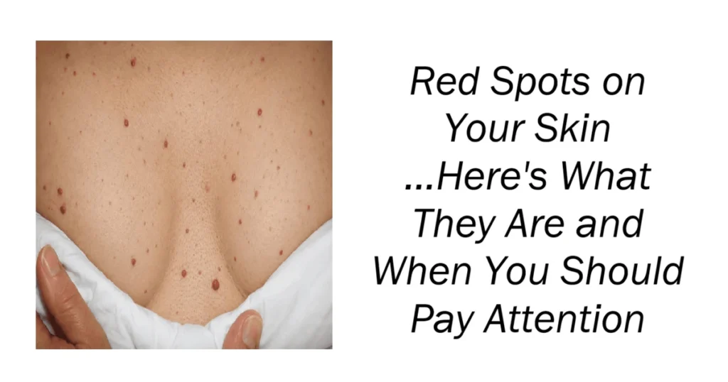 Red Spots on Your Skin