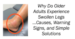 Why Do Older Adults Experience Swollen Legs