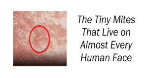 The Tiny Mites That Live on Almost Every Human Face