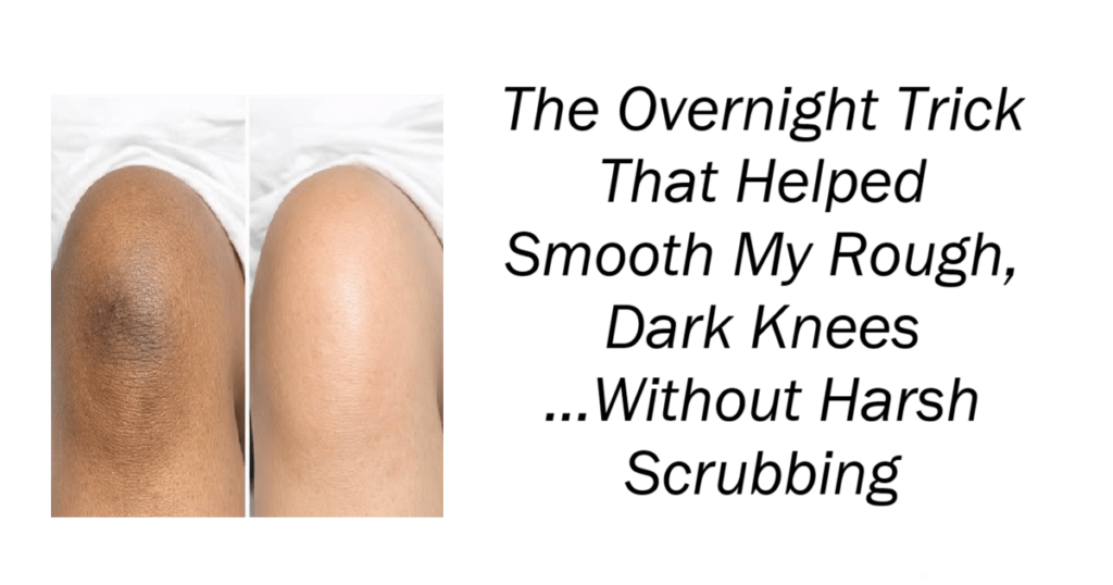 The Overnight Trick That Helped Rough Dark Knees