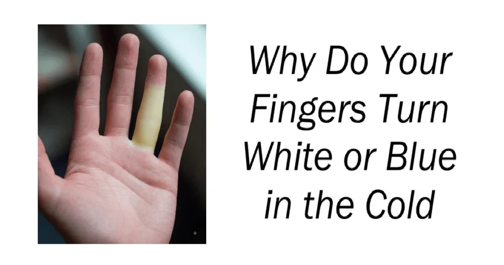 Why Do Your Fingers Turn White or Blue in the Cold