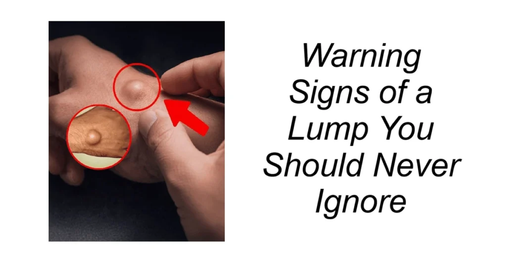 Warning Signs of a Lump You Should Never Ignore