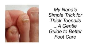 My Nana’s Simple Trick for Thick Toenails
