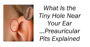 What Is the Tiny Hole Near Your Ear