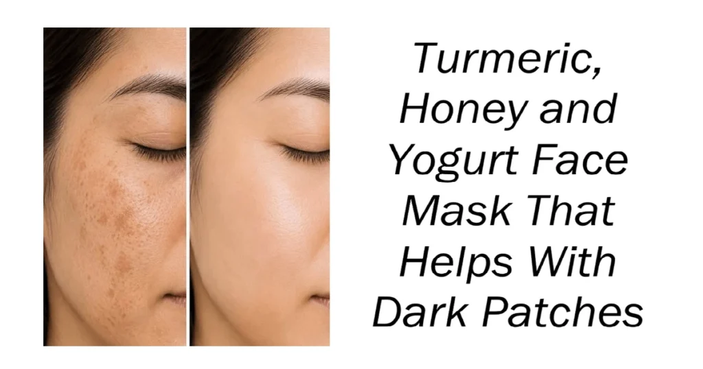 Turmeric, Honey and Yogurt Face Mask That Helps With Dark Patches